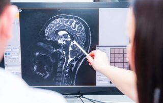 doctor looking at scan of a brain
